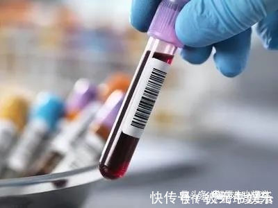 月经紊乱|当女人出现这个症状,是说明快要绝经了吗