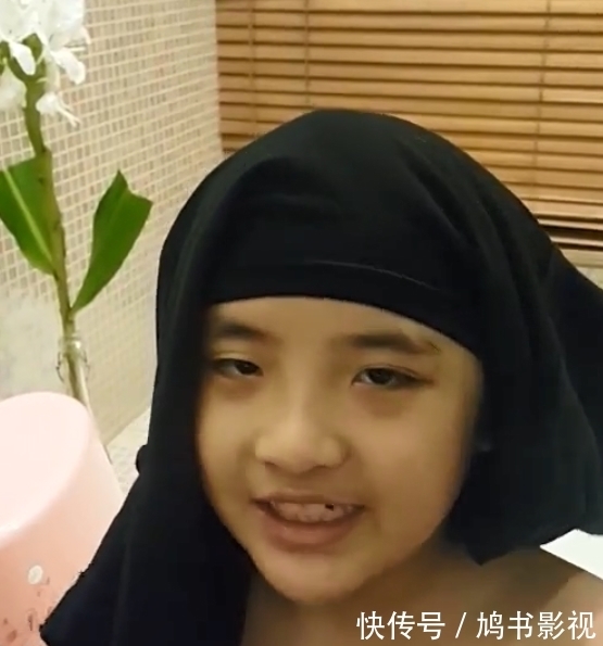 正臉|錄《爸爸去哪兒》造成眼角永久性傷害的費曼露,放下心結露正臉