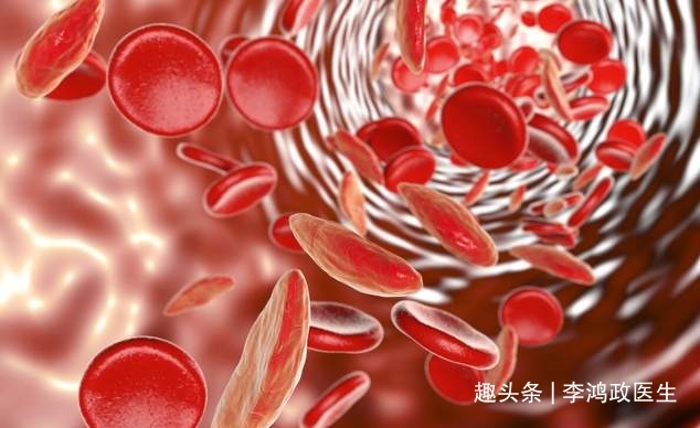 医生|女子头晕半年，以为患癌症，检查结果让她觉得重获新生