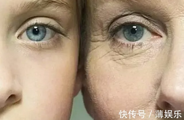 油脂|多走路能降血脂医生提醒日常多吃这4物,或比走路效果好