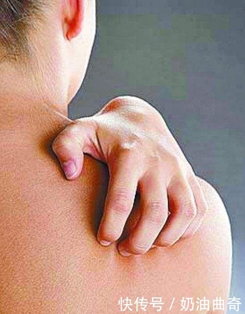 复发|数亿只螨虫爬上身导致背后痘痘频发,3个方法解决,很难复发