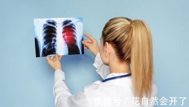 症状|肺癌早期症状是什么样的肿瘤科医生把最关键的内容说出来了