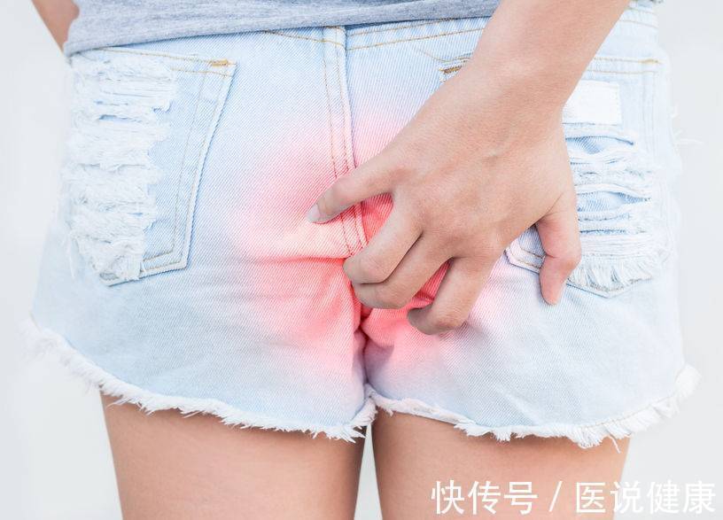 内痔|肛肠疾病发生时,身体或有4种异常表现,需重视,发现后及时检查
