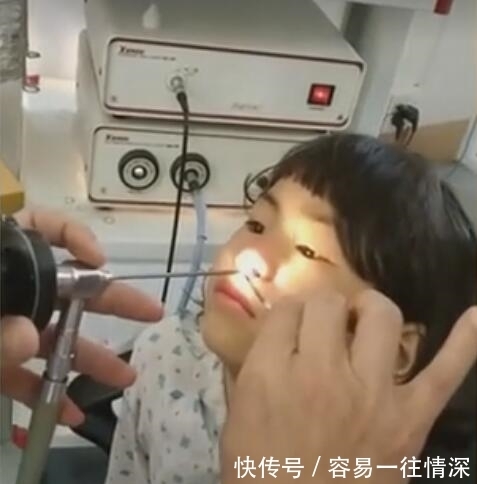 活虫子|奇闻:医生从小女孩鼻子里取出一条活虫子,女孩看见后一脸淡定