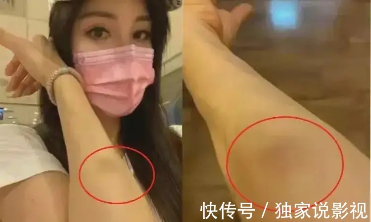 杨丽菁坦言没戏拍，惠英红拒绝拍动作片，功夫女星中还有谁在坚守