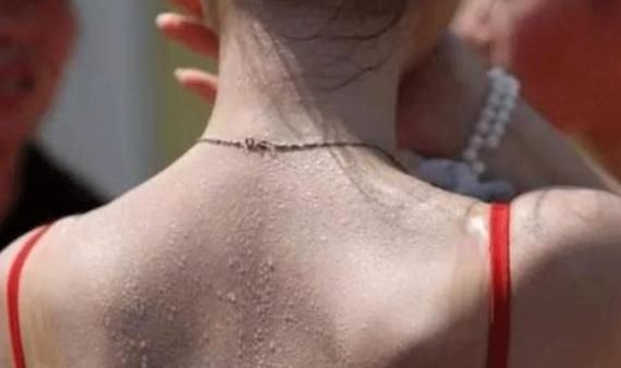 阴虚体质|动不动就出汗和不出汗的人,哪种人的“体质”更好呢?你清楚吗?