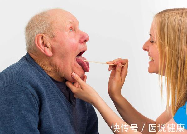 患者|慢性咽炎反复发作,或是这6个因素引发的,若你有,需了解