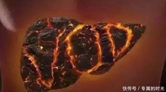 泡水|决明子是个“宝”?每天用来泡水喝,或许3件“好事”自己找上你