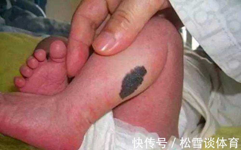 淡青色|孕期别干5件事,不然胎记找上宝宝,不然长大被孩子怨恨