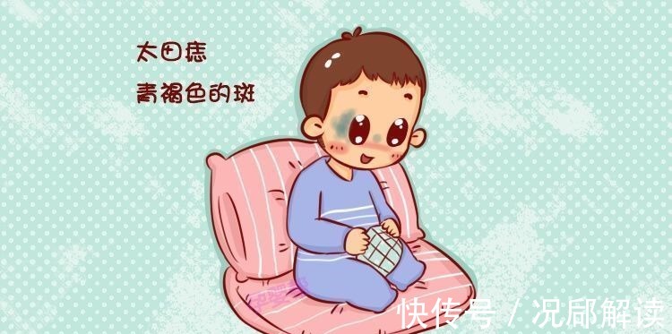 咖啡斑|怀孕期间,不想“胎记”赖上宝宝,准妈妈看完后避开这2种行为