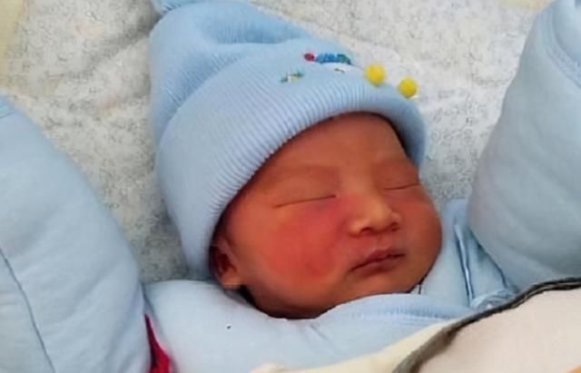 垃圾食品|胎记是如何形成的?产科大夫:除了遗传,和孕妈3种不良行为有关