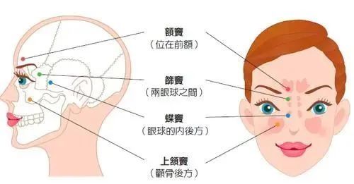 头痛|鼻塞、头痛、流脓鼻涕千万别当感冒治