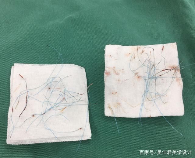 从老阿姨到小姐姐，降低年龄感她选择这样做！