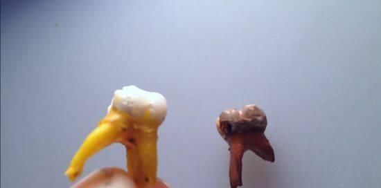 咖啡因|碳酸饮料为什么要杜绝?来看那些长期喝可乐的人后来都咋样了?