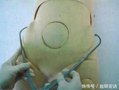 测量|孕期“骨盆测量”一般什么时候做?提前了解,关乎能不能顺产生娃