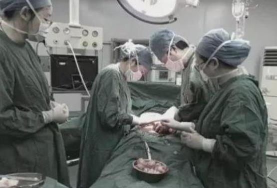 顾女士|38岁女性腹痛不止,医生在她子宫中取出大大小小61个,从未遇到过