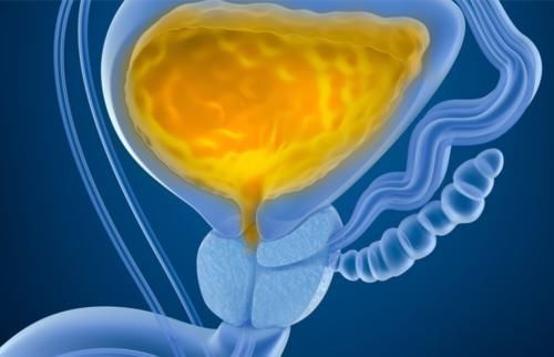 老大哥|65岁男士无痛血尿就诊,医生庆幸:警惕性高,及时发现了早期癌症