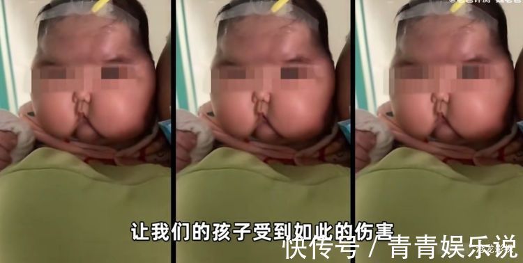 母婴|“大头娃娃”卷土重来?5个月孩子用母婴产品变成大头娃娃!
