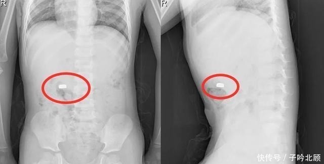 安全意识|“妈妈,我有个秘密”听完5岁儿子说的话,宝妈抱着孩子冲进医院!