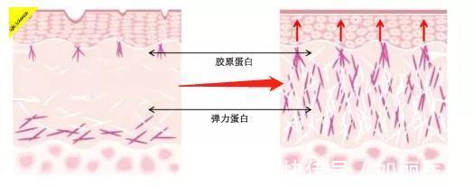 护肤 微针or水光补水？肤质改善的必经之路，“不破不立”医美护肤指南！