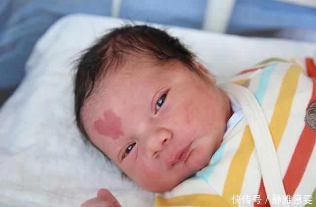 胎记|胎记代表上辈子去世的方式网友大开脑洞那这个死法还真特别