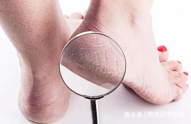 代茶饮|肝不好的人,手脚会有5种表现,若一个不占,恭喜你,肝脏很健康