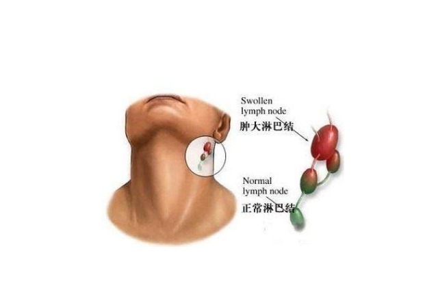 胃气|老中医们是如何治疗癌症的划重点来啦！做好2点比什么都重要