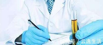 嘌呤|尿酸高的人，少吃5类食物，多吃3物，帮你降尿酸，远离痛风困扰