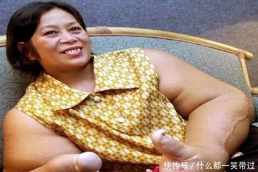 吉尼斯|吉尼斯世界之最:第二项纪录获得者因病意外破纪录,网友:好大