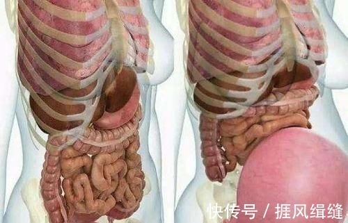 痔疮|怀孕280天,孕妇的内脏都去哪了?一张图告诉你“妈妈的伟大”