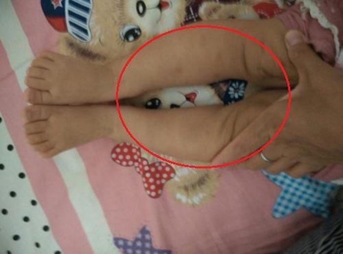 外国|为啥中国孩子那么多“罗圈腿”,外国孩子却很少,这些坏习惯要改