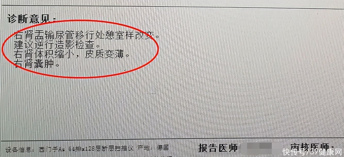  判断|一喝水就上厕所和喝水却没尿意，哪个才是肾脏不健康？如何判断？