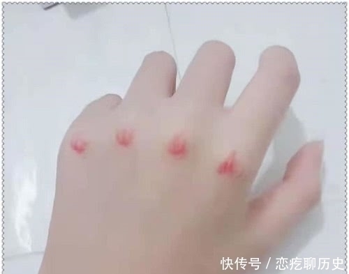 美术生|美术生手上画“拳击伤”,开始:这水平一般般,结局:男友看到会心疼吗?