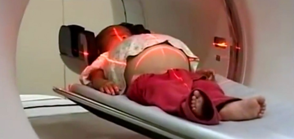 肚子|一岁半女婴意外“怀孕”,体内被查出死胎,手术途中吓坏医生