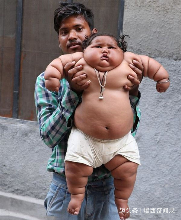 父母|男孩一天吃46顿饭总喊吃不饱,去医院检查后,医生怒斥其父母!