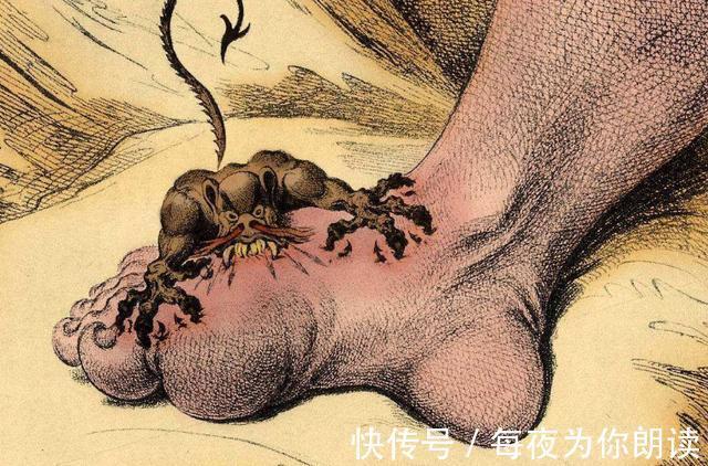 尿酸|再次强调痛风人群，4种食物不忌口，铁打的身体也扛不住