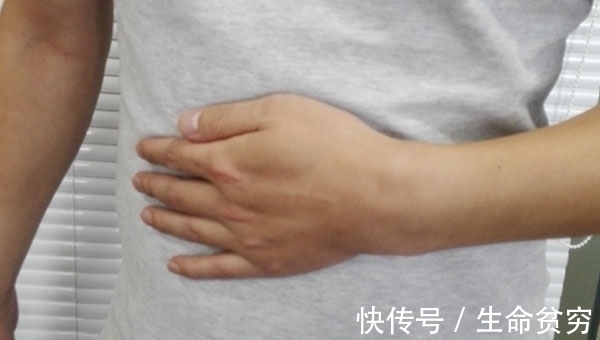 生冷食物|十胃九病,慢性胃炎的症状有哪些?想远离胃病,吃饭牢记两点