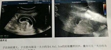 孕妈|孕期,若是怀了“小王子”,孕妈产检单上可能会出现3个“数据”
