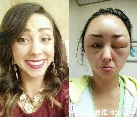 危机|说好的安心变美,染发膏热销榜首竟然频频爆出产品质量危机