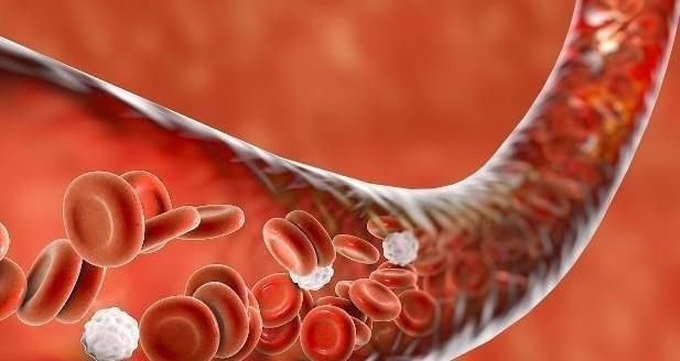 血管堵塞|心内科医生:血栓最怕1个动作,每天坚持20秒,让血管重获新生!