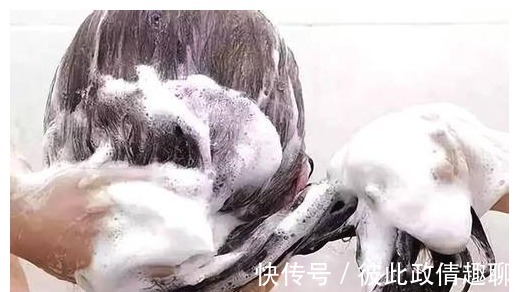 指甲|洗头发掉发严重怎么办!几个洗头小技巧,帮助改善掉发问题