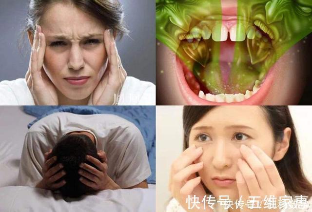 口臭|久蹲不排这1物冲水喝,便秘绕道走,清肠排便,口臭消失