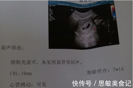 早孕检查|怀孕期间,这5项检查能安全通过,说明宝宝健康聪明,准妈可放心