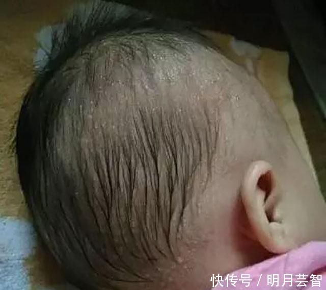 疾病|孩子睡觉时,若有这3个表现,多半是疾病发出的信号,妈妈要留心