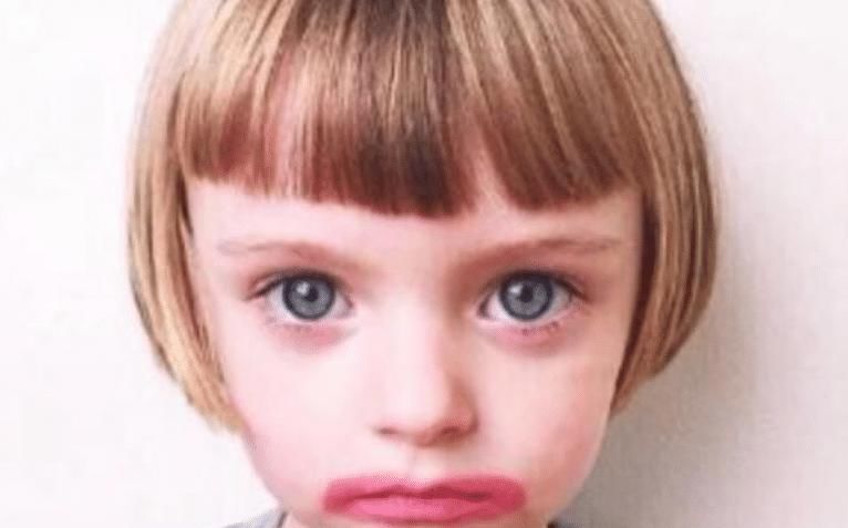 偏食|导致偏食的原因还有,由于饮食习惯长期不良,孩子拒绝吃某种食物