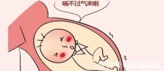 胎动|孕期这些胎动极不正常, 若疏忽大意, 可能酿早产或流产!