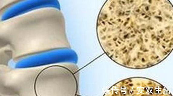 骨质疏松就吃药？建议多吃“3物，常做1事”，骨质紧密更健康