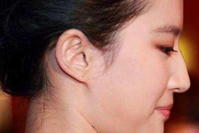 鼻型|公认最丑的4种“鼻型”,每1种都很影响颜值,希望你一个不中