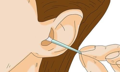 耳朵|为什么有的人耳朵会“流油”?是优势还是劣势?听听医生怎么说