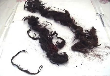 慈禧太后|光绪之死(上):比慈禧早死20小时12分钟,他到底是不是被毒死的